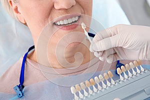 Dentist selecting patient`s teeth color with palette in clinic