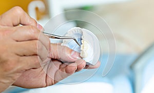 Dentist showing ceramic dental cast