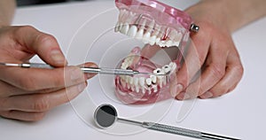 dentist showing dental problems on jaw model. tooth decay