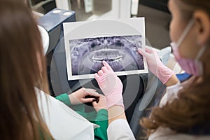Dentist showing the details of x-ray picture to female patient in dental office and preparing for treatment. Dentistry