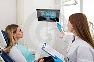 Dentist showing patient jaw teeth x-ray image. Doctor and woman client during consultation at dental clinic. Issues discussing.