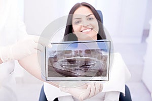 Dentist showing x-ray