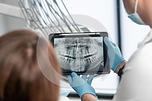 The dentist shows the results of panoramic tomography of the patient& x27;s teeth on a tablet. The patient receives an