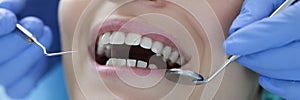 Dentist with steel instruments in his hands examines patient`s teeth closeup
