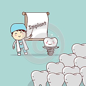 Dentist teach teeth implant