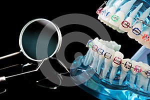 dentist tools and orthodontic model.