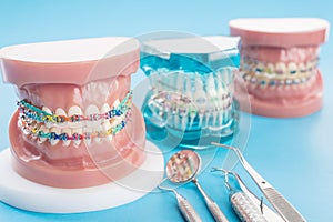 dentist tools and orthodontic model.