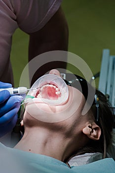 Dentist treat a female patient in dentistry. Treatment concept. Stomatological tool kit. Closeup hightech Dentist equipments