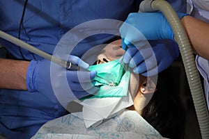 Dentist treating a patient`s teeth with dental tools in dental clinic. Dentistry.