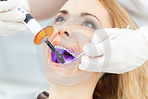 Dentist using dental curing UV lamp on teeth of patient