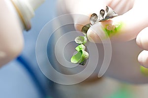 Dentist using occlusal spray on fixed denture