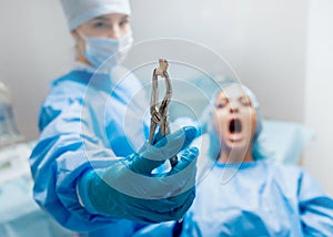 Dentist using surgical pliers to remove a decaying tooth.