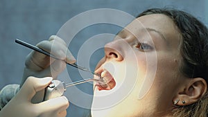 Dentist is washing his teeth with a mirror to a beautiful European woman. Visit to the dentist