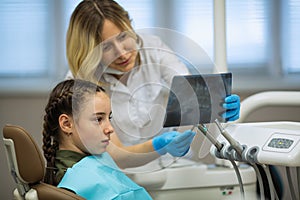 Dentist woman shows an x-ray to a little girl patient in dental clinic