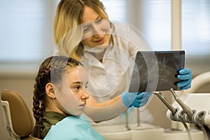 Dentist woman shows an x-ray to a little girl patient sitting in a dental chair in dental clinic