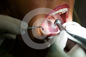 Dentist working closeup