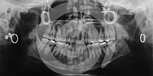 Dentist x-ray