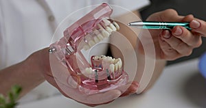 Dentistry and implantology - dentist implantologist with human teeth jaw model in hand