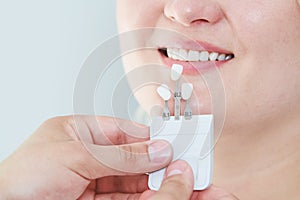 Dentistry. matching colour of the tooth enamel with whitening chart