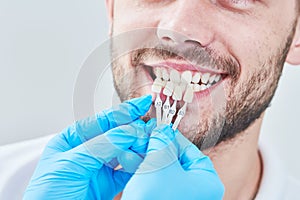 Dentistry. matching colour of the tooth enamel with whitening chart photo