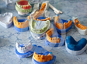 Dentistry molds