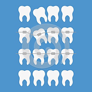 Odontoiatria impostato illustrazioni apparecchi per i denti un appartamento 