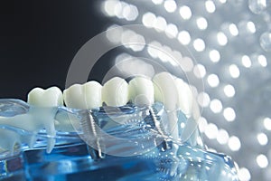 Zubaři zubní zuby implantát 