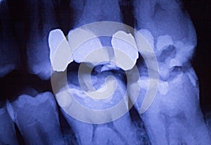 Dentists dental teeth xray