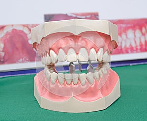 Dentoform, Dental teeth model
