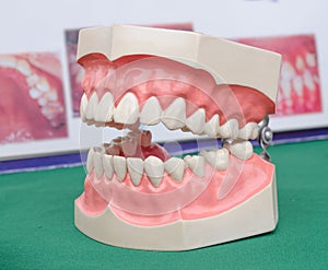 Dentoform, Dental teeth model
