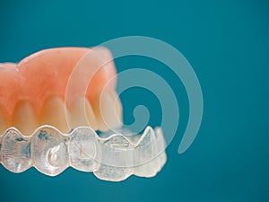 A DENTURE FITTING THE INVISALING BRACES ON A BLUE BACKGROUND photo