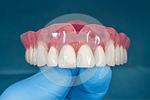 Denture. Full removable denture of the upper jaw of a man with white beautiful teeth in the hand of a dentist. Aesthetic Dentistry