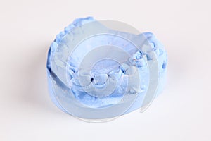 A denture gibs model