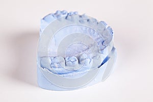 A denture gibs model