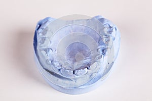 A denture gibs model