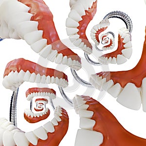 Denture Model Droste