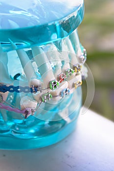 Klasický zubní kov ortodoncie barevný háčky 