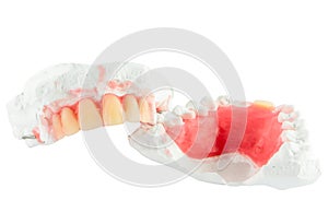 Denture teeth with wax model isolate