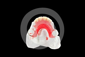 Denture wax model