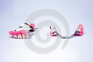 Dentures with crowns. dental prosthetics. dentistry. replacement of missing teeth. metal prostheses