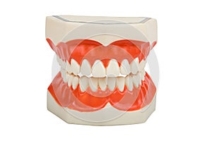 Dentures, dental prosthesis