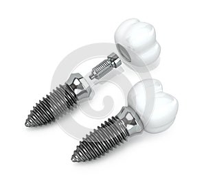 Dentures and implants on a white background.