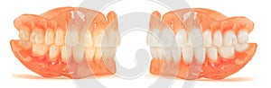 dentures. Isolate on white background acrylic prosthesis of human jaws. The concept of orthopedic dentistry