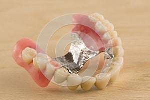 Dentures with metal-ceramic crowns