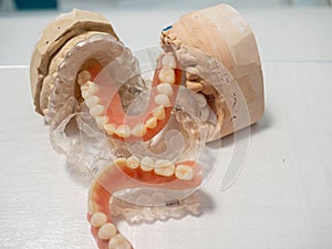 DENTURES, MOLDS, INVISALING AND DIFFERENT DENTISTS' OBJECTS ON A WHITE BACKGROUND photo