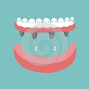 Dentures ,teeth and tooth concept of dental