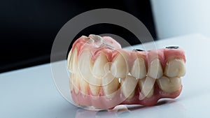 Dentures on a white background, dental implants