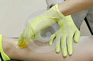 Depilation on the legs. female hands in gloves do shugaring.