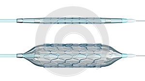 Deployed and collapsed stent ready for angioplasty isolated on white background 3D rendering illustration. Medical, surgery,