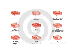 Dermatological elements in various diseases